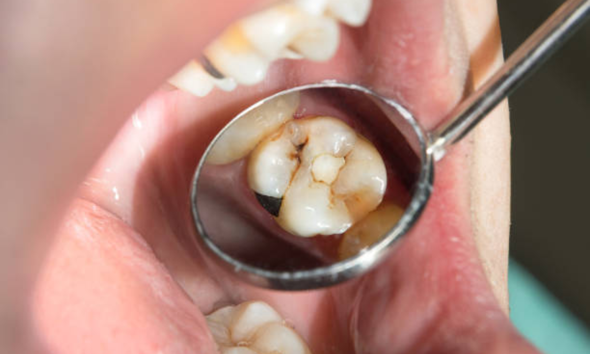 Kids dentistry treatment