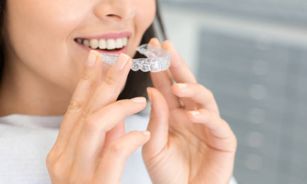 Clear aligners