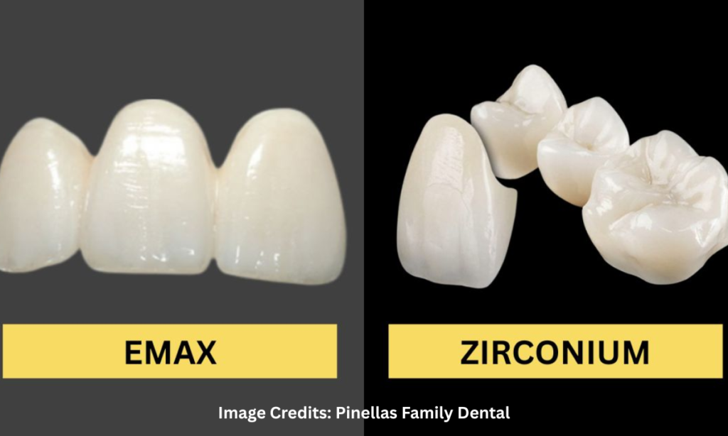 Zirconia and E-max