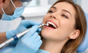 Polishing and Flossing