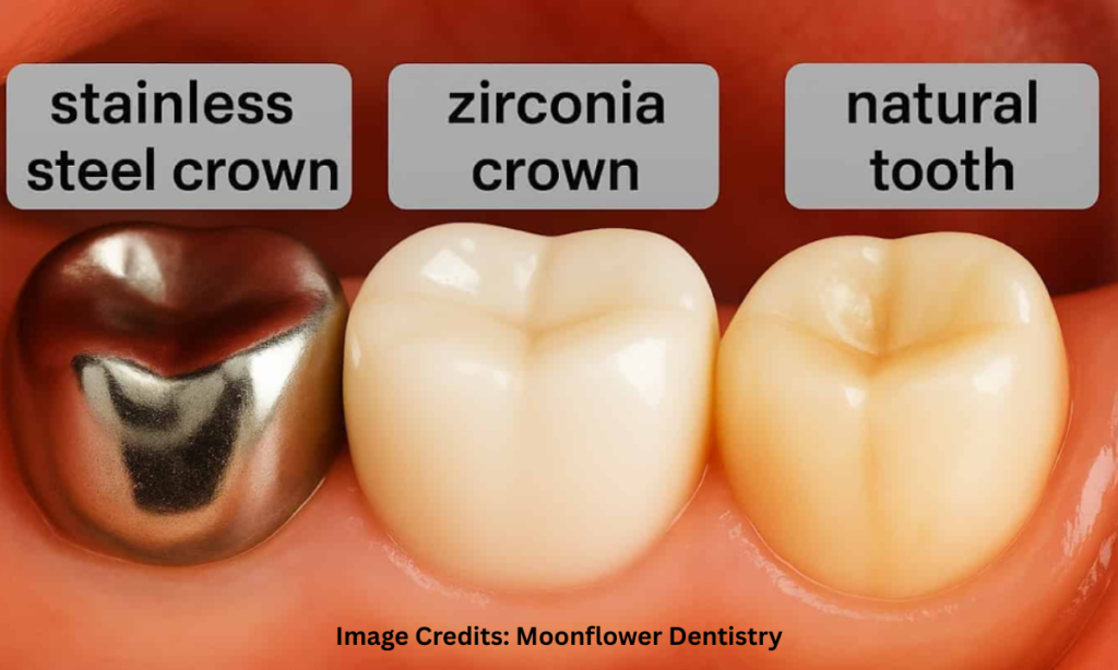 Types of Dental Crowns