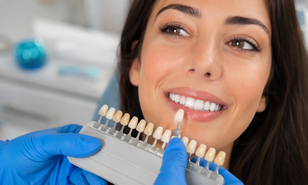 Porcelain Veneers